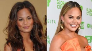 Chrissy-Teigen-Before-and-After-Plastic-Surgery-Journey.jpg