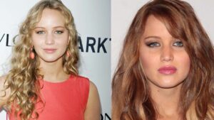 Jennifer-Lawrence-Before-and-After-Plastic-Surgery-Journey.jpg