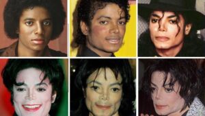 Michael-Jacksons-Before-and-After-Plastic-Surgery-Journey.jpg
