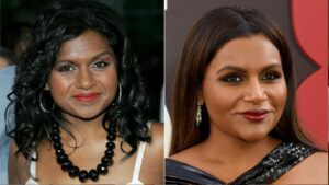 Mindy-Kaling-Before-and-After-Plastic-Surgery-Journey.jpg