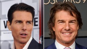 Tom-Cruise-Before-and-After-Plastic-Surgery-Journey.jpg