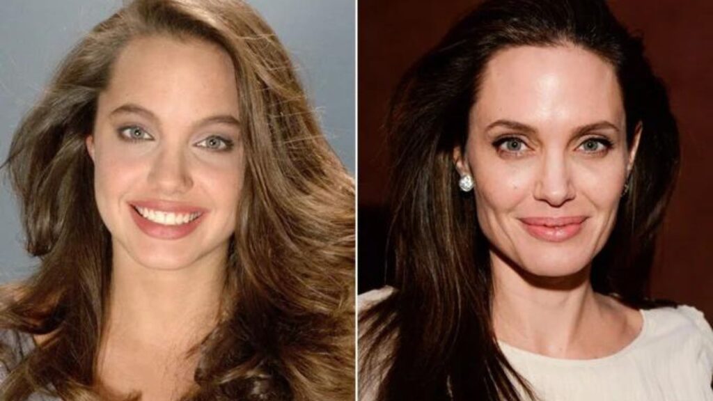 Angelina-Jolies-Before-and-After-Plastic-Surgery-Journey.jpg