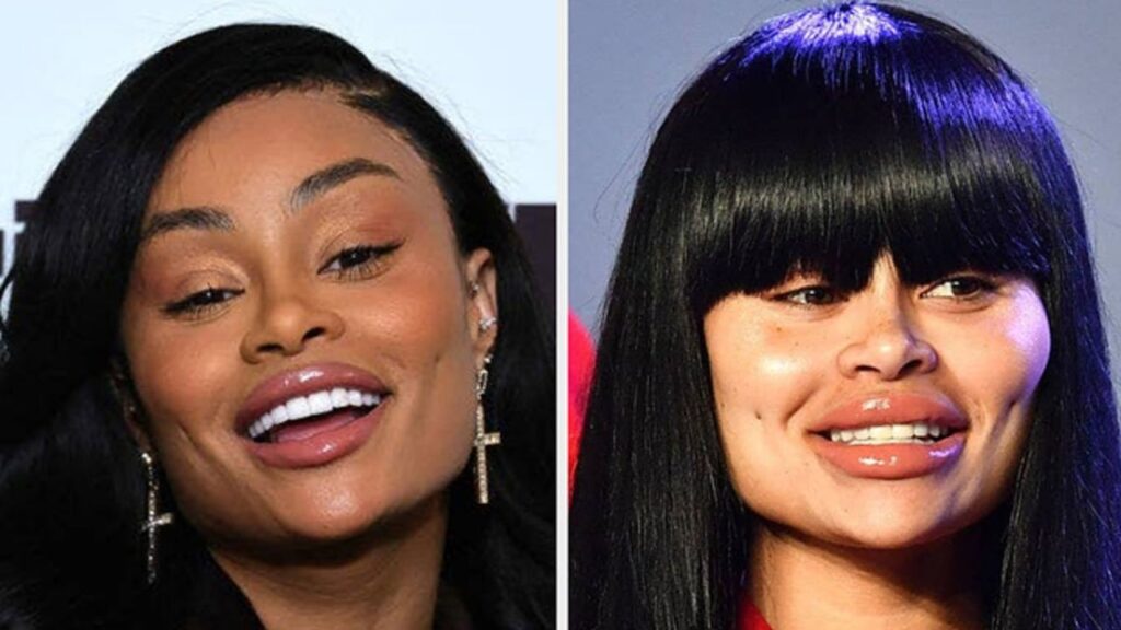 Blac-Chyna-Before-and-After-Plastic-Surgery-Journey.jpg