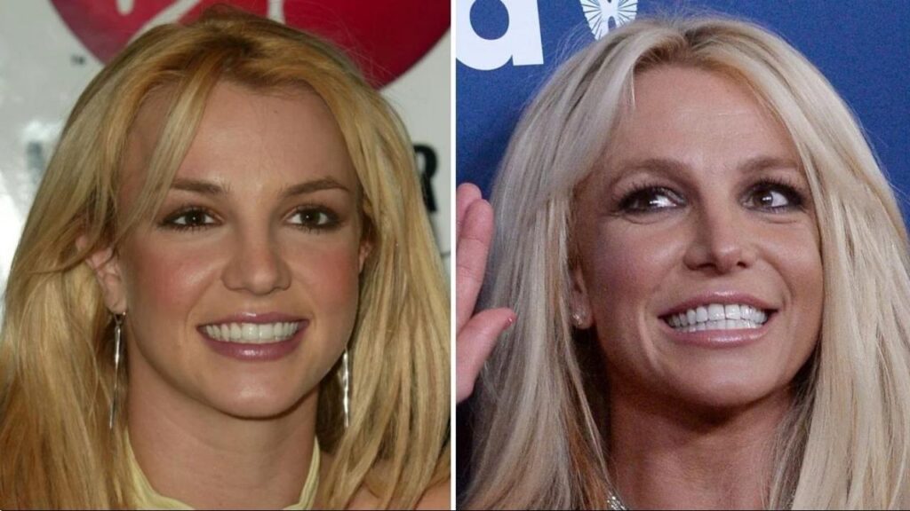 Britney-Spears-Before-and-After-Plastic-Surgery-Journey.jpg