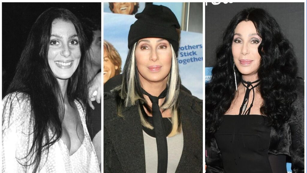 Cher-Before-and-After-Plastic-Surgery-Journey.jpg