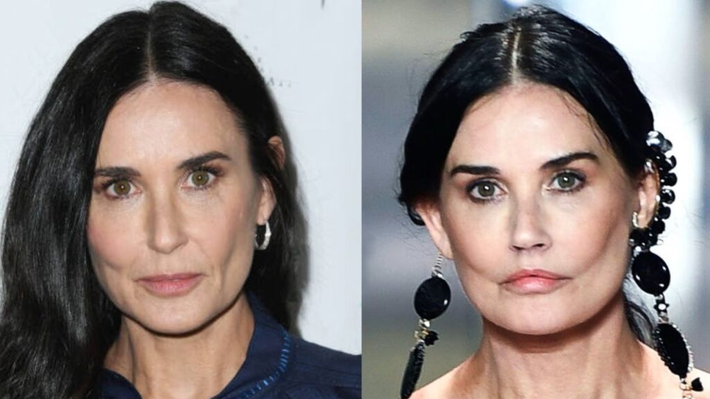 Demi-Moore-Before-and-After-Plastic-Surgery-Journey.jpg