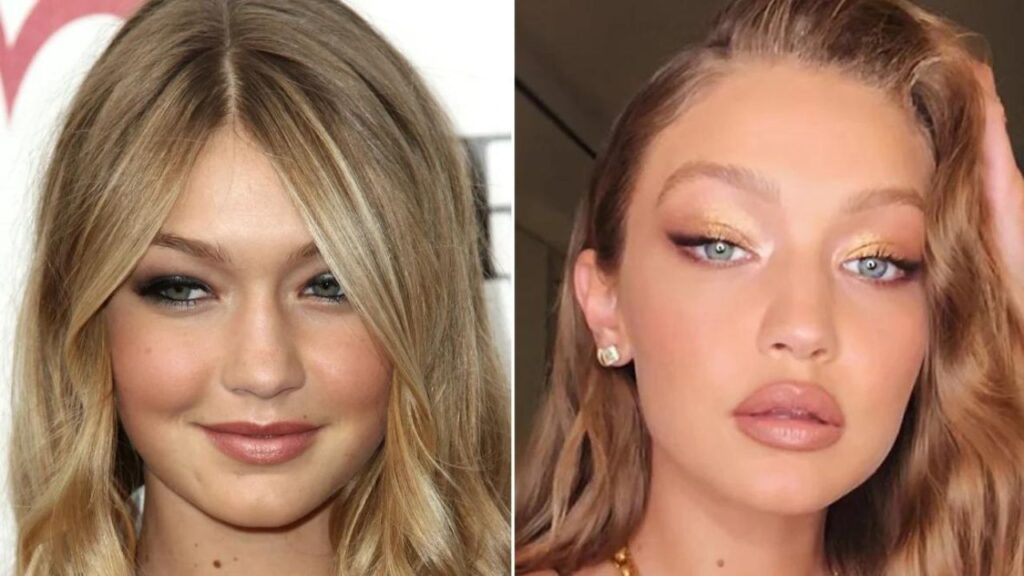 Gigi-Hadid-Before-and-After-Plastic-Surgery-Journey.jpg