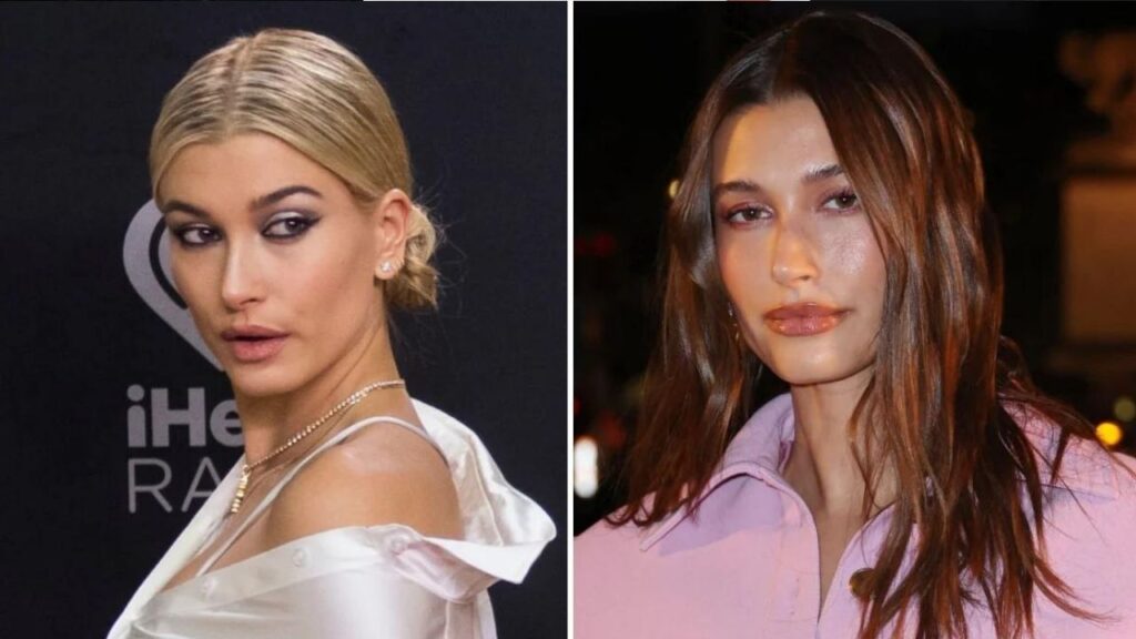 Hailey-Bieber-Before-and-After-Plastic-Surgery-Journey.jpg