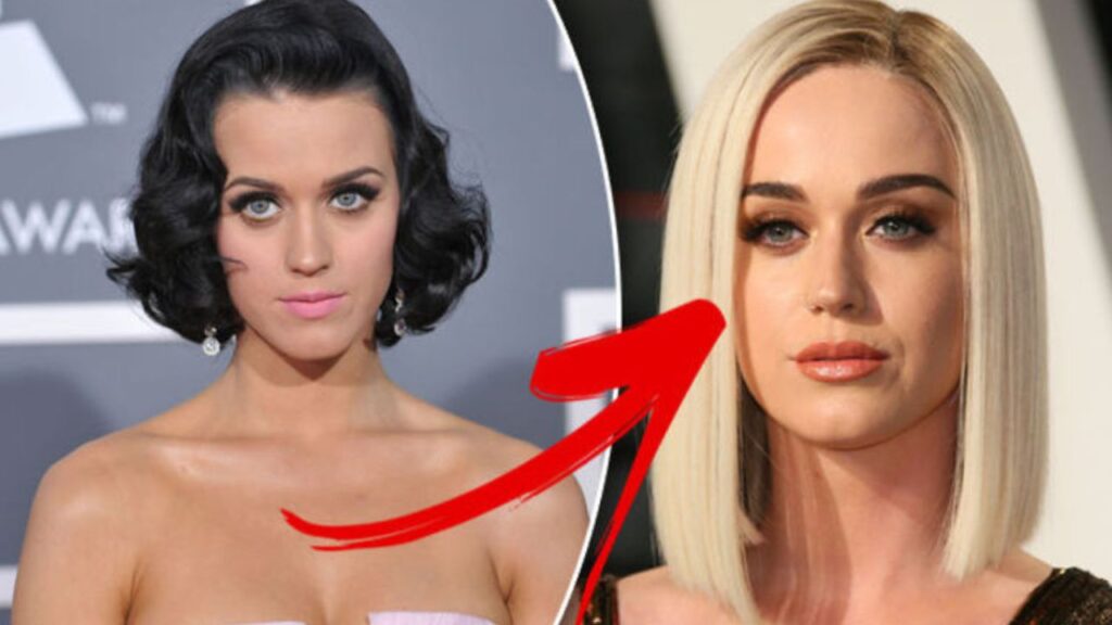 Katy-Perry-Before-and-After-Plastic-Journey.jpg