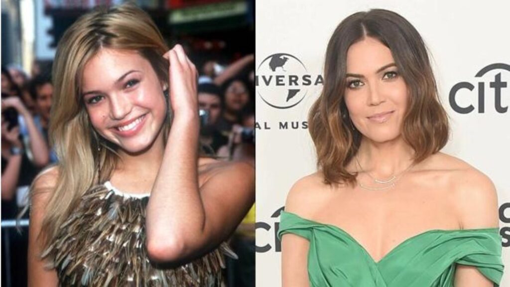 Mandy-Moore-Before-and-After-Plastic-Surgery-Journey.jpg
