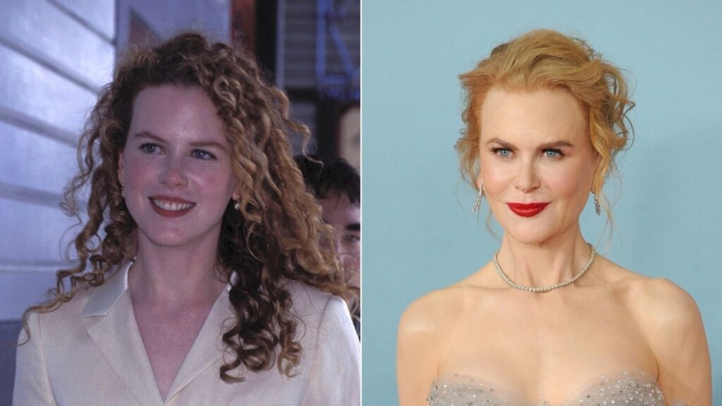 Nicole-Kidman-Before-and-After-Plastic-Surgery.jpg