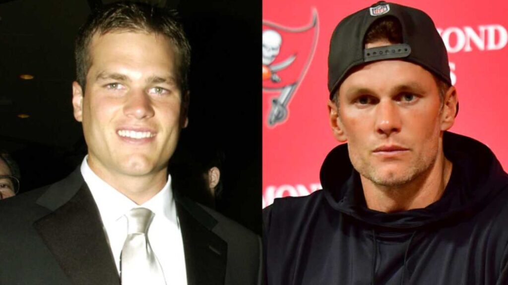 Tom-Brady-Before-and-After-Plastic-Surgery-Journey.jpg